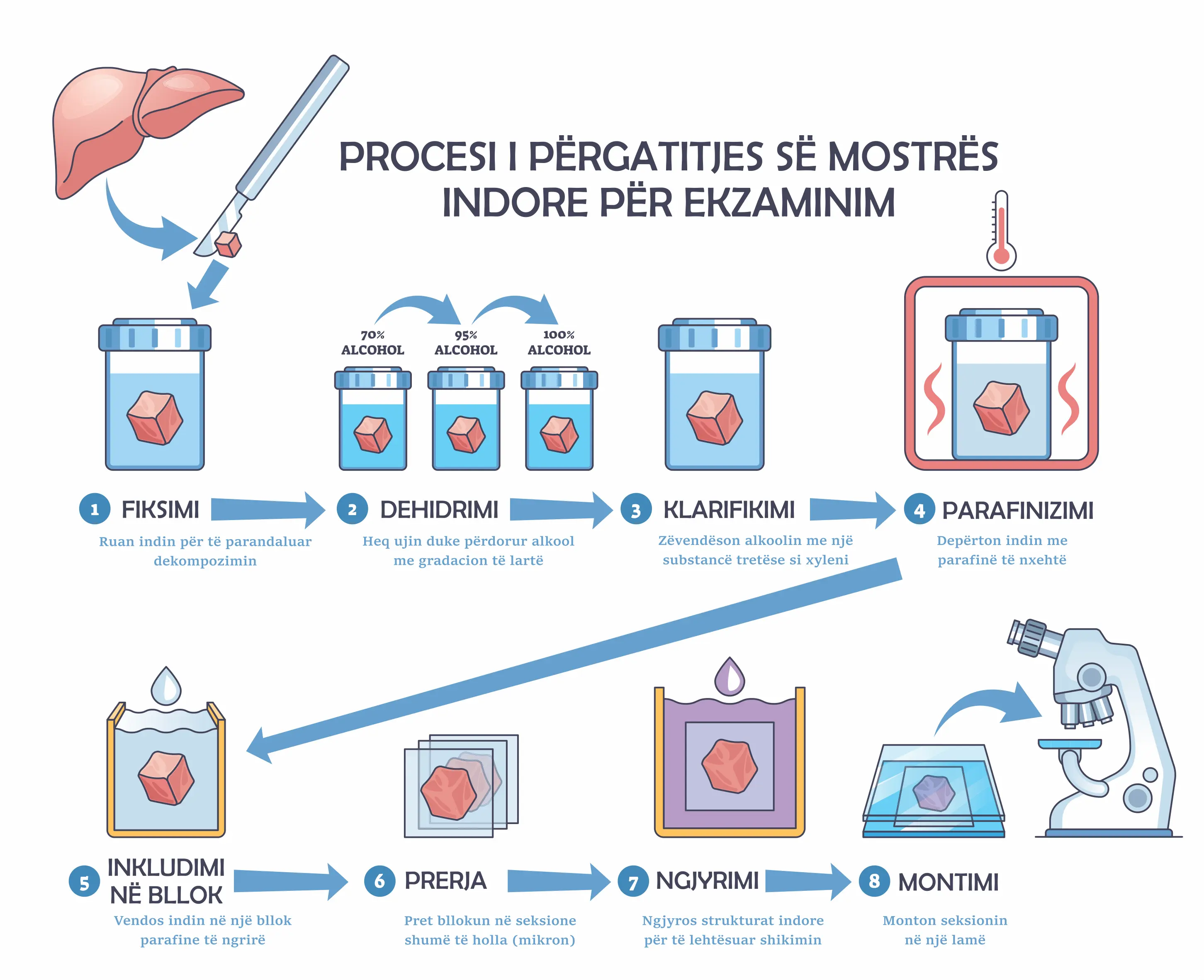 Diagram qe tregon procesin e pergatitjes se mostres indore per ekzaminim histopatologjik
